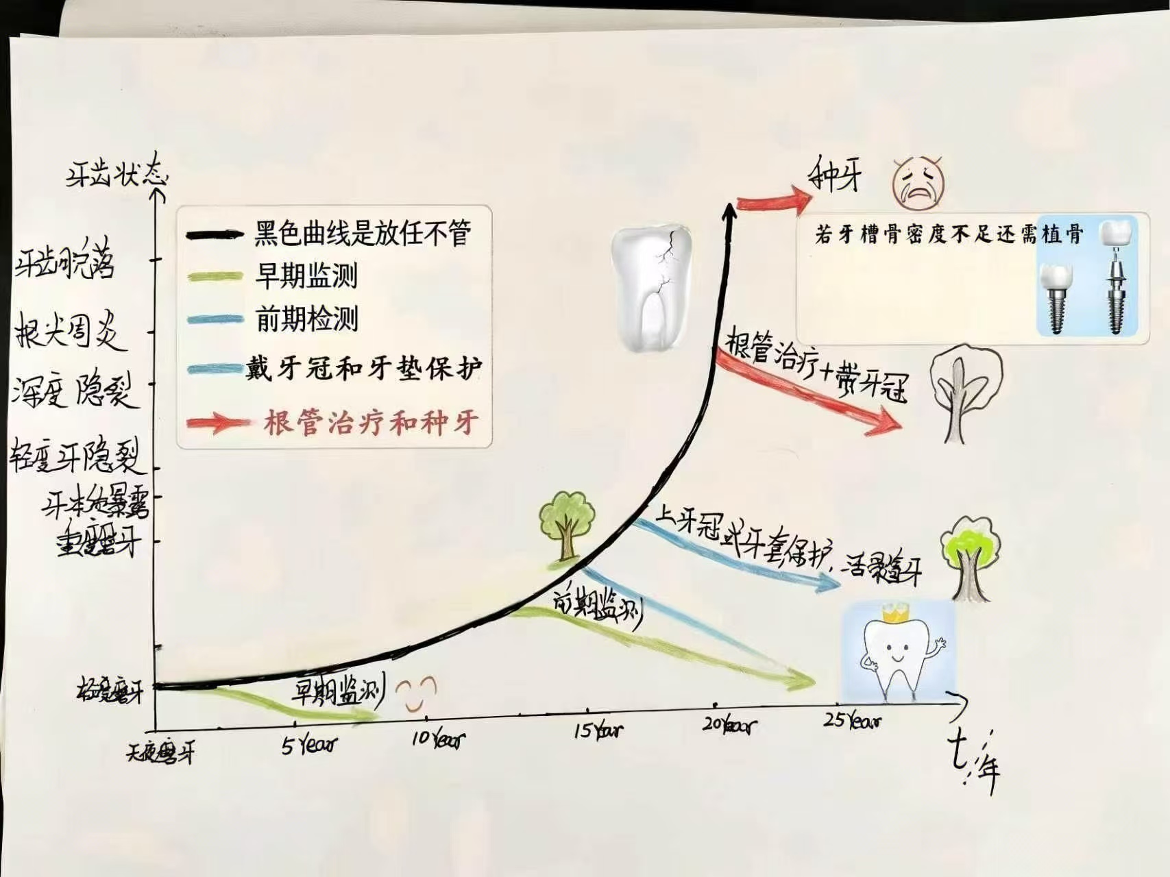 牙齿从健康到隐裂再到种植的过程示意